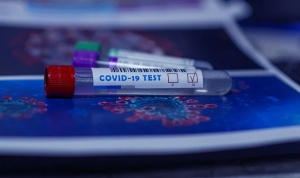 За счет областного бюджета будут делать ПЦР тест родственникам больных коронавирусом